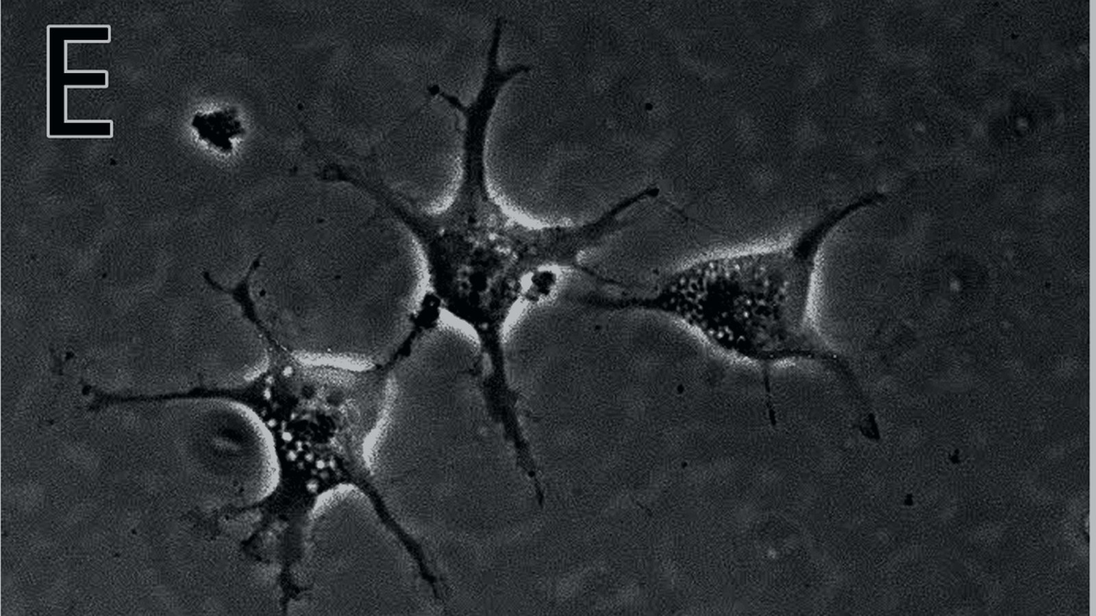 Patient-derived remyelination assay dish