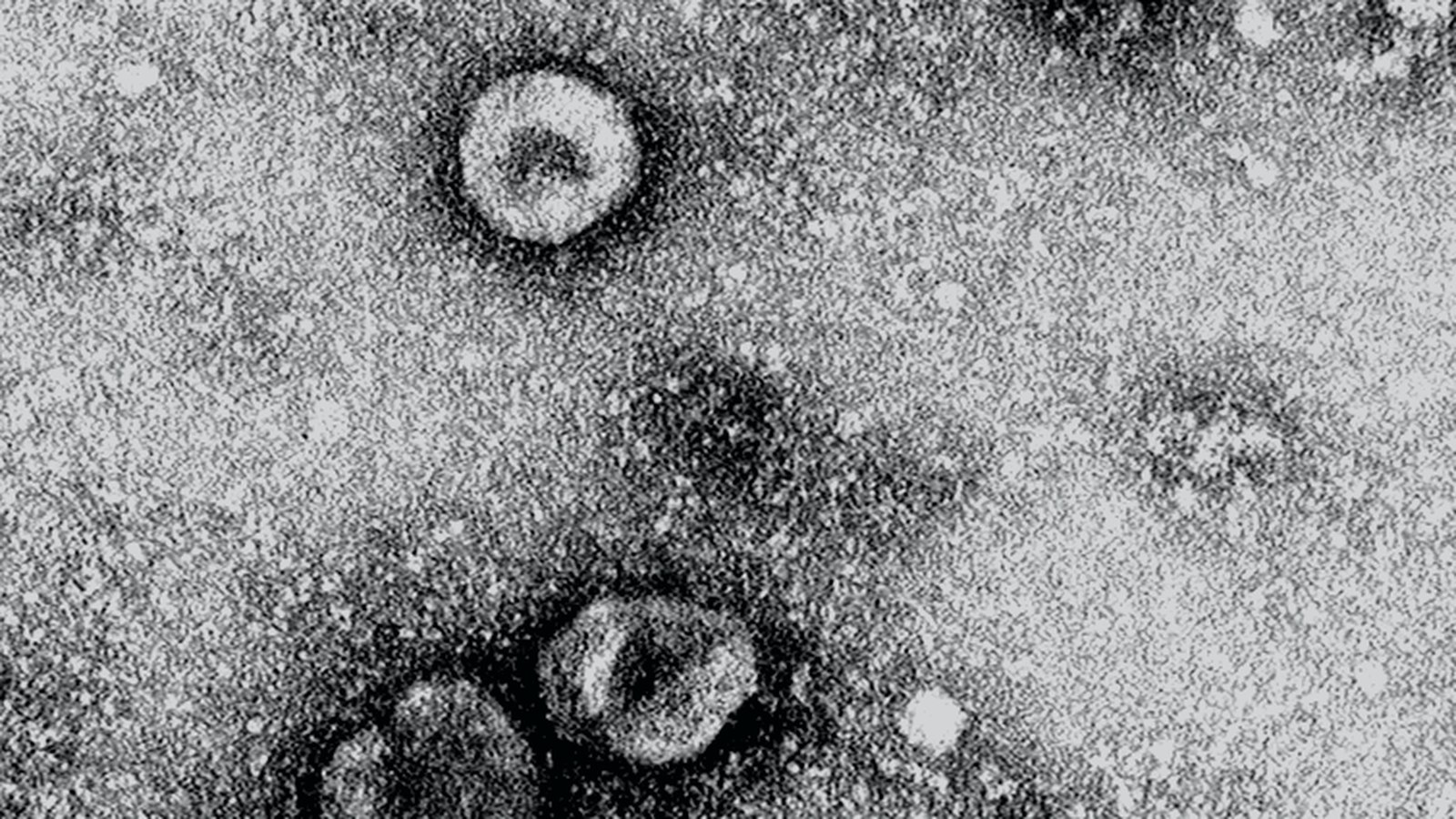 NV-Trinity nanovesicles targeting CNS barrier receptors